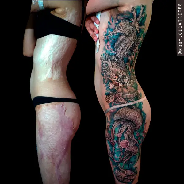 Antes y después de tatuaje sobre cicatrices: escena marina a color con caballito de mar, tortuga y medusas en costado, cadera y pierna, Buenos Aires