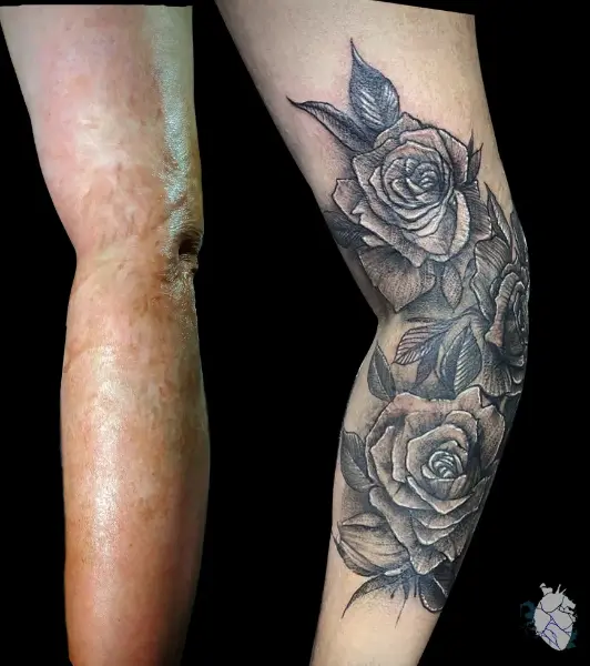 Antes y después de tatuaje sobre cicatrices: rosas en black and grey cubren cicatrices en el brazo y la zona del codo, trabajo de Eddy en Recoleta